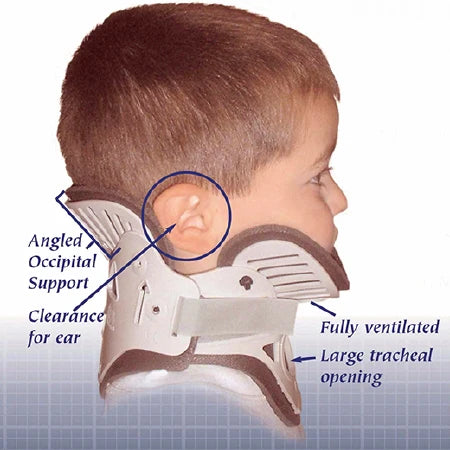 NecLoc - Rigid Cervical Collar Preformed Pediatric (2 to 6 Years) Size P2 Two-Piece / Trachea Opening - NL-P2