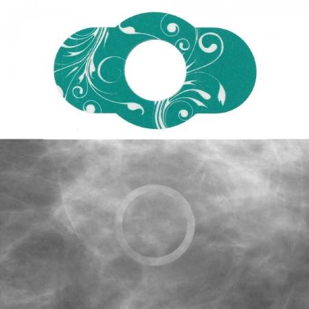 Precision Dynamics Spee-D-Line Swirl Collection Mammography Mole Marker 1/2 Inch Inner Diameter - SDG-MSD3