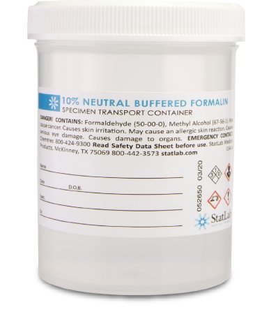 StatLab Medical Products - Prefilled Formalin Container 120 mL Fill in 240 mL (8 oz.) Screw Cap Warning Label / Patient Information NonSterile - NB08120
