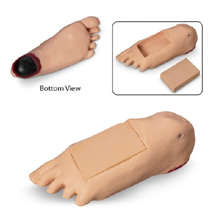 Life/form Geri - Optional Edema Foot with Deep tissue Injury - LF04084