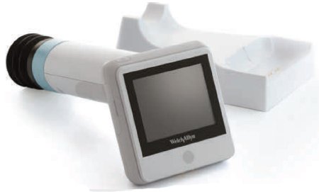 Welch Allyn RetinaVue 100 Diabetic Retinopathy Imager - RV100-B