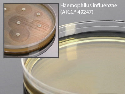 Hardy Diagnostics - Haemophilus Test Medium Agar 15 X 150 mm For Susceptibility Testing - H07