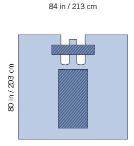 Invenio Healthcare SteriGuard Orthopedic Drape Bilateral Drape Sterile - I80-02101G-S