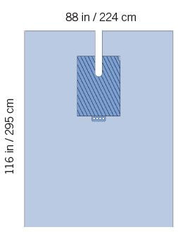 Invenio Healthcare SteriGuard Orthopedic Drape Orthopedic Split Drape 88 W X 116 L Inch Sterile - I80-09145G-S
