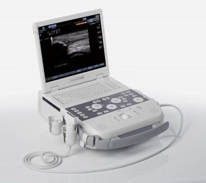 Acuson P300 - Ultrasound System Portable Dicom with ECG Cable, 15 Inch XVGA LCD Monitor, 1024 X 768 Monitor Resolution, Trackball, CP Back-Lighting, 1 Hour and 20 min Battery, 2 cm Minimum Depth of Field, 36 cm Maximum Depth of Field - 124329