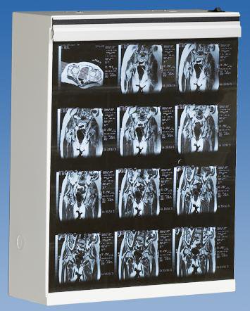 Wolf X-Ray MG-7 X-Ray Illuminator 2 Bank 1 Tier 2 Lamp 15 W Free Standing - 21801