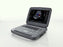 Acuson P500 - Ultrasound System Brianheeringamd, Touch Screen, Track pad, 1 (3 with Connector), up to 1 Hour Battery, Sleep Mode (Quick Start), 2 cm Minimum Depth of Field, 32 cm Maximum Depth of Field - Global Medical Imaging - 125375