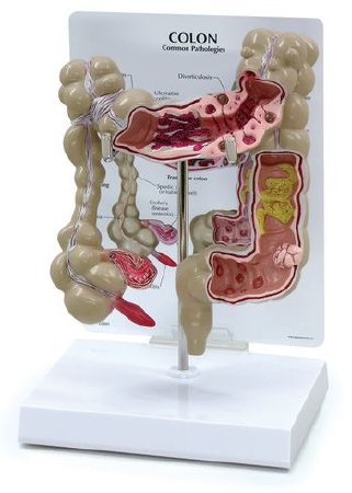 Nasco - Colon Model - SB35434