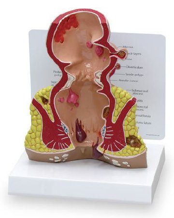 Nasco - Rectum - SB35433