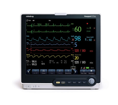 Patient Monitor