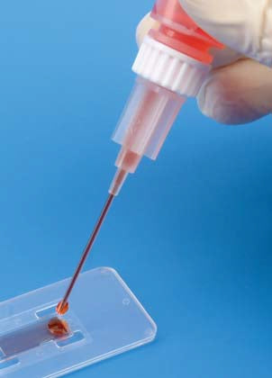 PANTek Technologies LLC LeukoChek Test Kit Leukocyte Test Whole Blood Sample 50 Tests - BMP-LUKCHK-50