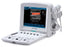 Edan Usa Ultrasound System U50 Series 12.1 Inch Display Size, 2 Usb Ports, 504 Mb Built-In Image Storage, 256 Frames Cine Loop Memory - U50 PRIME