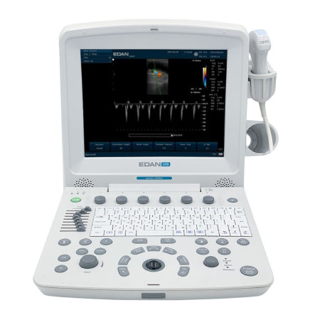 U50 Series - Ultrasound System 12.1 Inch Display Size, 2 USB Ports, 504 MB Built-In Image Storage, 256 Frames CINE Loop Memory - U50 PRIME
