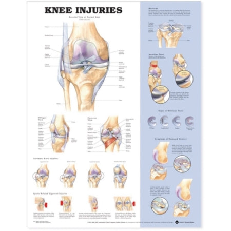 Patterson Medical Supply Anatomical Chart Knee Injuries 20 X 26 Inch Premium Paper Wall Mount Gloss - 81631779