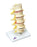 Fabrication Enterprises Vertebrae Degeneration, Stages of Prolapsed Disc Model 2 lbs. - 965307