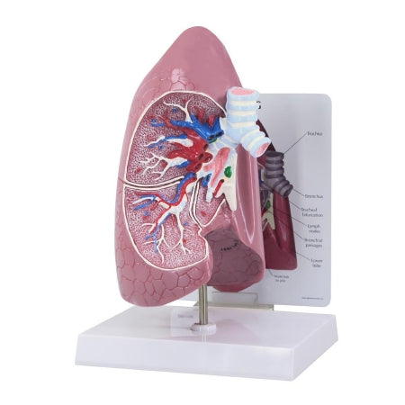 Fabrication Enterprises 3B Scientific Lung Model - Z02804