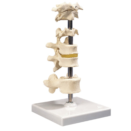 Fabrication Enterprises 6 Mounted Vertebrae Model 4 lbs. - 983935