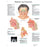 3B Scientific - Anatomical Chart Rhinitis and Sinusitis 19-7/10 X 26-2/5 Inch UV Resistant Paper Laminated - Z13398
