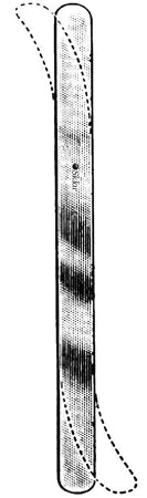 Ribbon Retractor