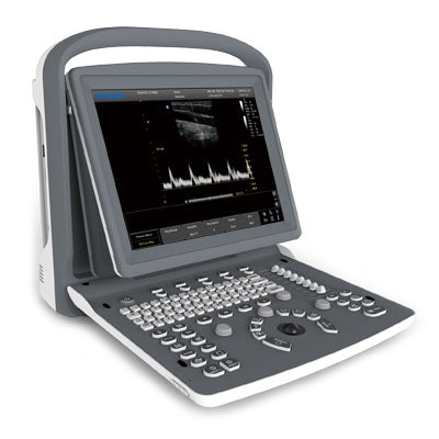 Chison - Ultrasound System 256 Levels Scale, 240 mm Max Depth Scanning, 3 USB ports, 1 Probe Connectors, 8 GB Memory Card, PW Mode - CHISON EC02