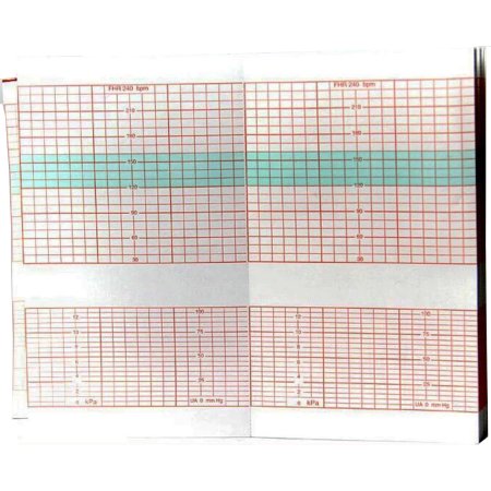 Edan - Fetal Diagnostic Monitor Recording Paper Thermal Paper 90 mm X 152 mm Roll Red Grid - M25R-75111