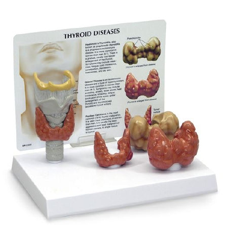 Nasco - Thyroid Model - SB46541