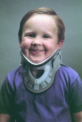 Aspen - Rigid Cervical Collar Preformed Adult Regular Two-Piece / Trachea Opening 13 to 21 Inch Neck Circumference - 62397