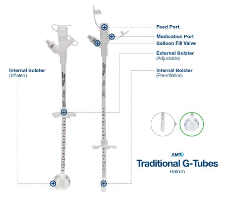 Applied Medical Technologies AMT Gastrostomy Tube 14 Fr. Adjustable up to 10cm Silicone - 7-1410