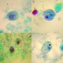 Scientific Device Lab - Microbial Identification Control Slide Giardia Lamblia 5 Slides - 475