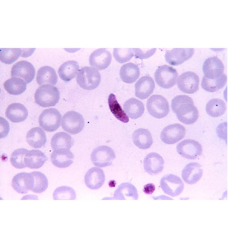 Scientific Device Lab - Parasitology Stained Slide 1 X 3 Inch Plain - 8969