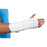 Breg Uni-Versatil Wrist Splint Adjustable Dorsal Stay Foam Left Hand One Size Fits Most - 100256-100