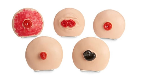 Nasco Life/Form Ostomy Care Training Models 8.5 lbs. - LF00898