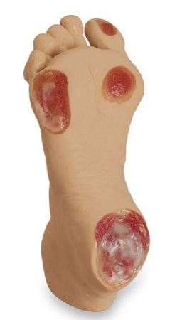 Nasco Life/Form Elderly Pressure Ulcer Foot - Light - LF00933