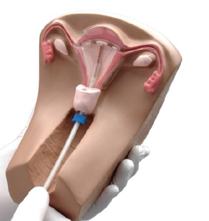 Nasco Gaumard Female Pelvic Organs Model - SB40534