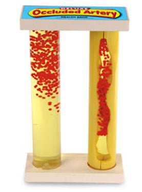 Nasco Occluded Artery Model Plastic - SB43034