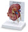 Nasco GPI Anatomicals Kidney Model w/ Pathologies - SB46337