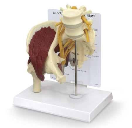 Nasco Galloway Plastics Muscled Hip with Sciatic Nerve Model - SB49530