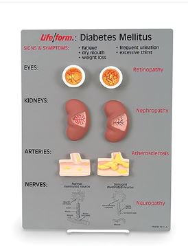 Nasco Life/Form Diabetes Mellitus Teaching Kit Life/form - WA20495