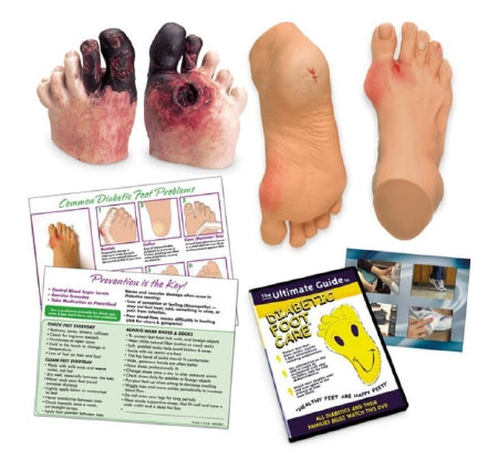 Nasco Life/form / TearPad Diabetic Foot Care Education - WA29842