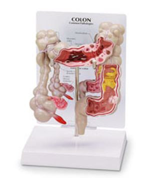 Nasco Nasco Colon Model - SB35434