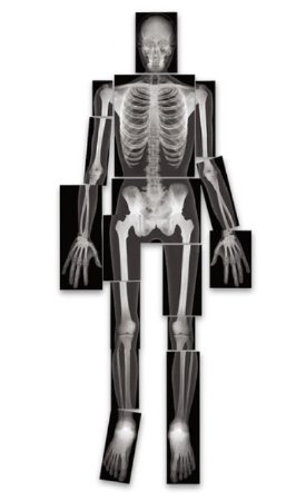 Roylco - True-to-Life Human X-Rays - SB40317