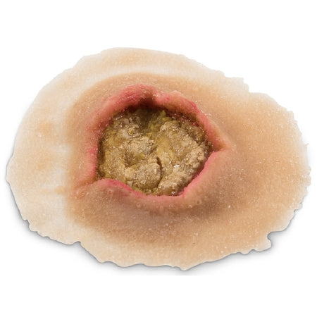 Nasco Moulage Sciences & Training MST Small Ulcer Moulage, Light Skin Color - Single - SB50205