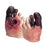 Nasco Life/Form Unhealthy Foot Care Kit Life - Size - WA21216