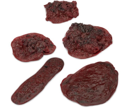 Life/Form - Clots and Hemorrhages - Set of 5 Life/form - LF00714