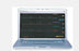 Simulaids Vitals 5 Line Monitor - 101-410INT WIFI