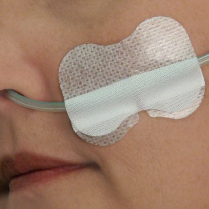 Tidi Products GRIP-LOK Nasal Gastric Securement Device Grip-Lok - 2100ANG