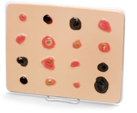 Life/Form - Skin Cancer Trainer Life/form - LF00950