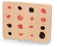 Nasco Life/Form Skin Cancer Trainer - LF00950
