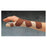 Northcoast Medical Splint Spica Liberty Wrist/Thumb 3Lmnt Fm Black Size 12" Small/Medium Left Ea - NC14660