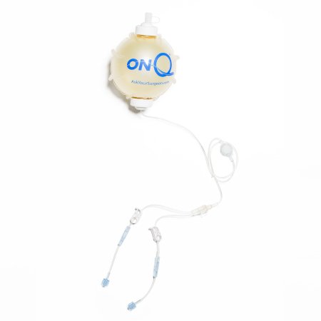 ON-Q* - Elastomeric Pump Gravity Disposable 270 mL Capacity 270 mL Volume 4 mL / Hr. Flow Rate - PM025-A